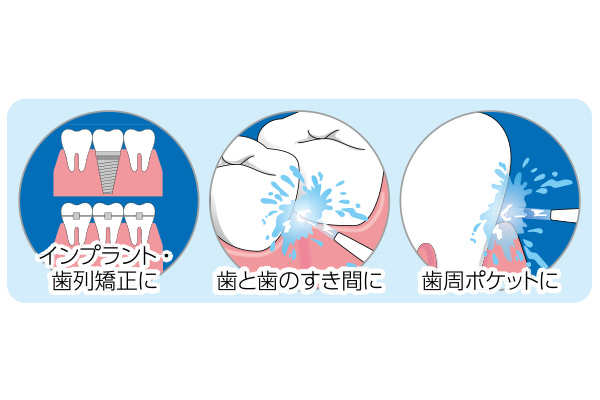 口腔洗浄器ジェットクリーンスマート