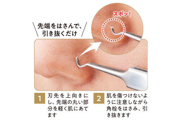 ステンレス製の角栓取り