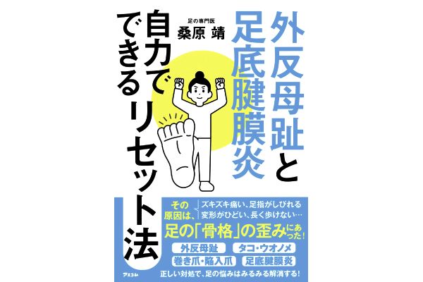 外反母趾と足底腱膜炎　自力でできるリセット法