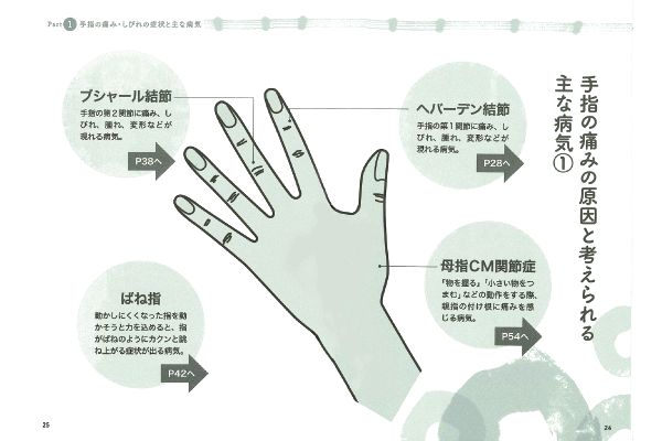 キャップが開けられない　指が痛い・こわばる人のお助けＢＯＯＫ