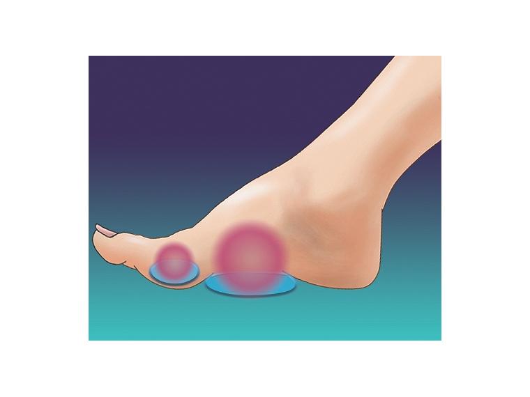 【ネット限定】クッション付き土踏まずサポーター　左右セット