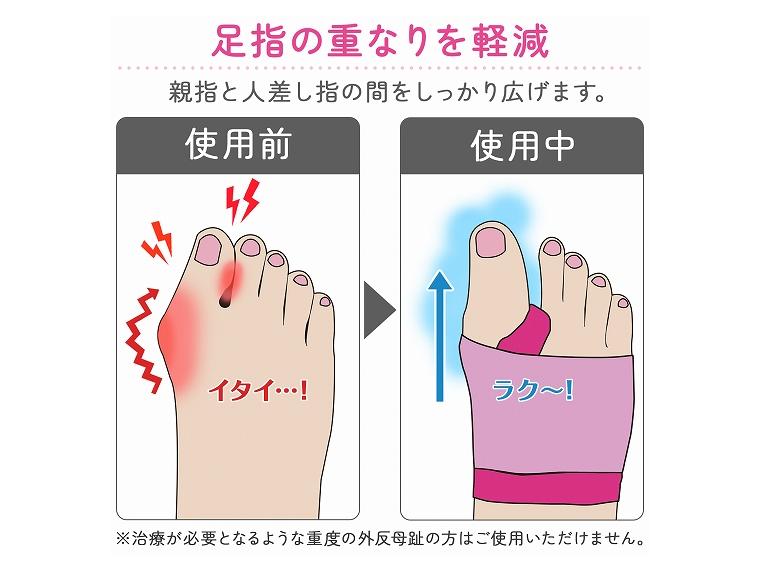 【ネット限定】おうちで外反母趾ソックス